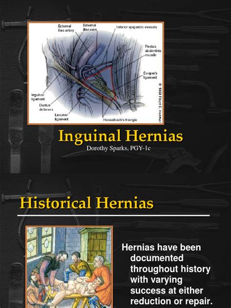 inguinal hernia patient education pdf